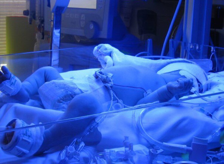 David Powell. Image of infant with blue lighting