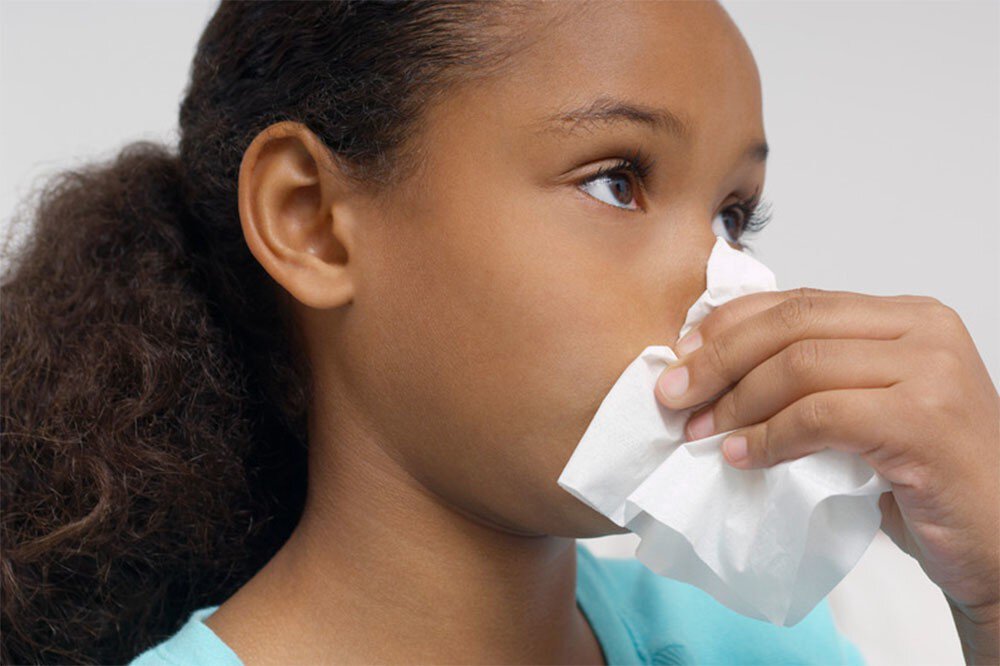A runny nose can be a sign of the flu, along with a fever, body aches, a headache and fatigue.