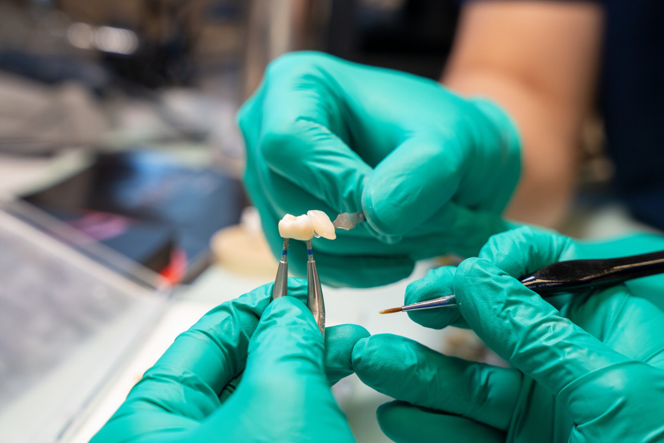 Two dentists wearing gloves examining a tooth being reconstructed