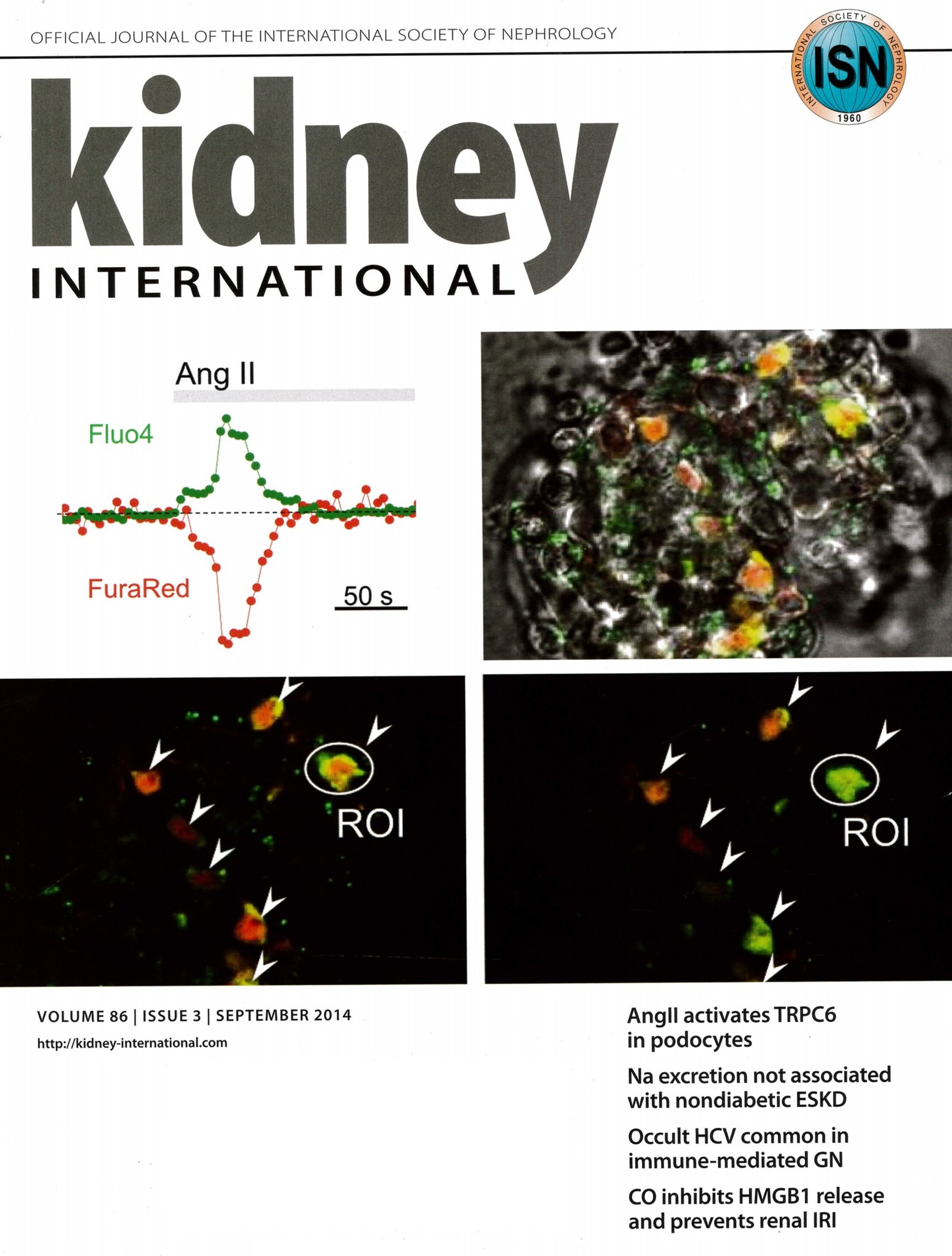 Kidney International Journal Cover