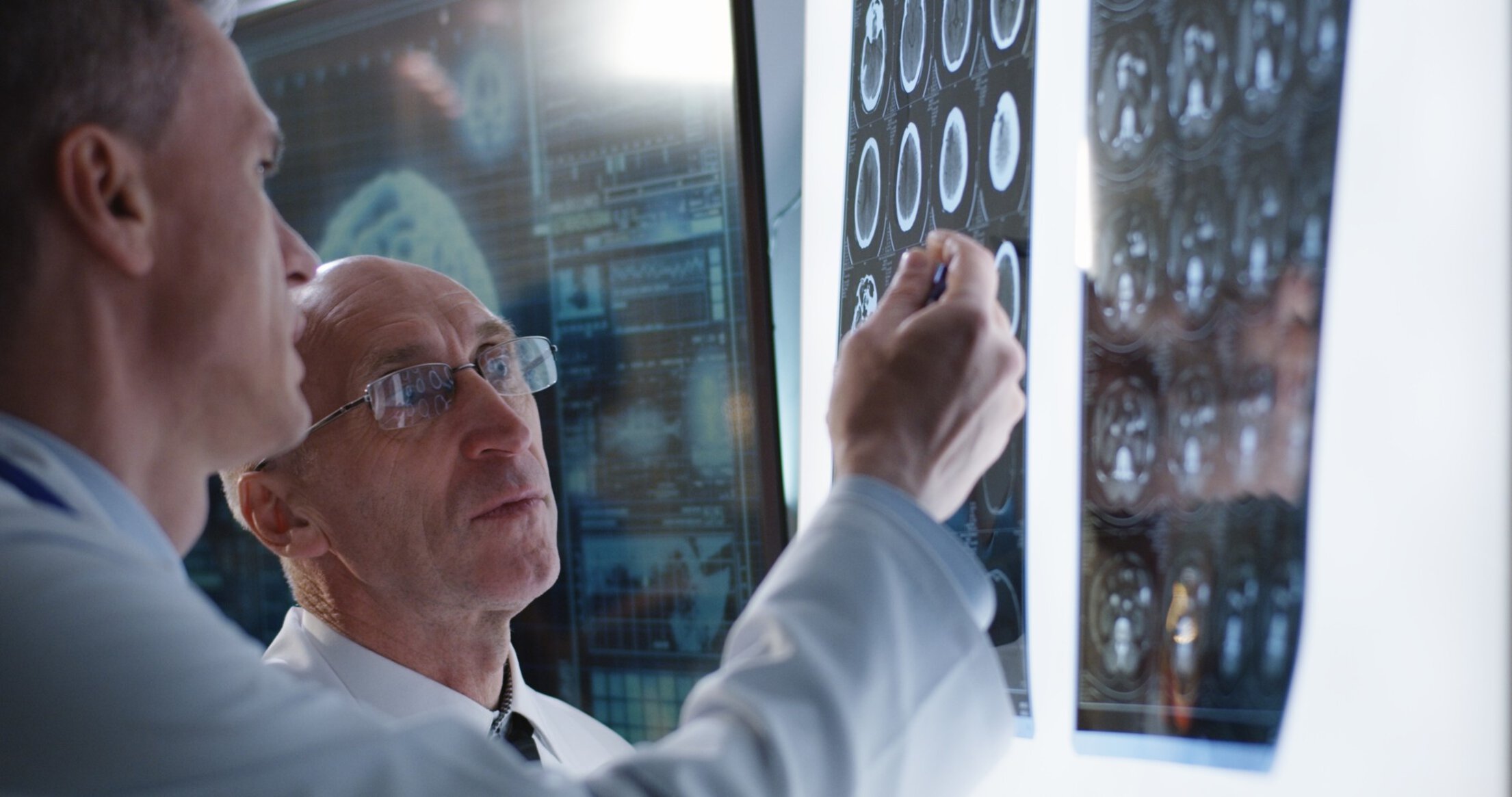 Two doctors reviewing brain scans in patients with Alzheimer's