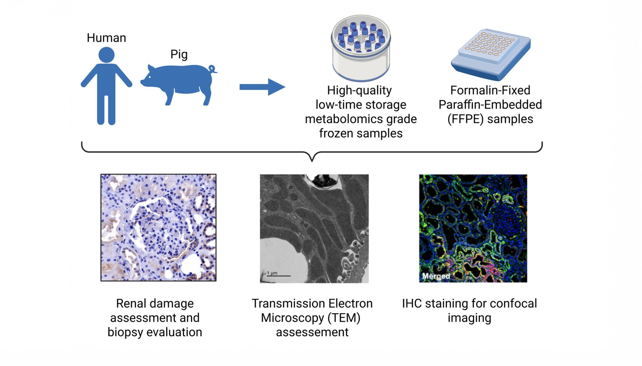 Illustration of a Kidney Translational Research Center workflow showing human and pig samples processed into high-quality, low-time storage metabolomics-grade frozen samples and formalin-fixed paraffin-embedded samples. The samples support renal damage assessment and biopsy evaluation, transmission electron microscopy assessment, and immunohistochemistry staining for confocal imaging.