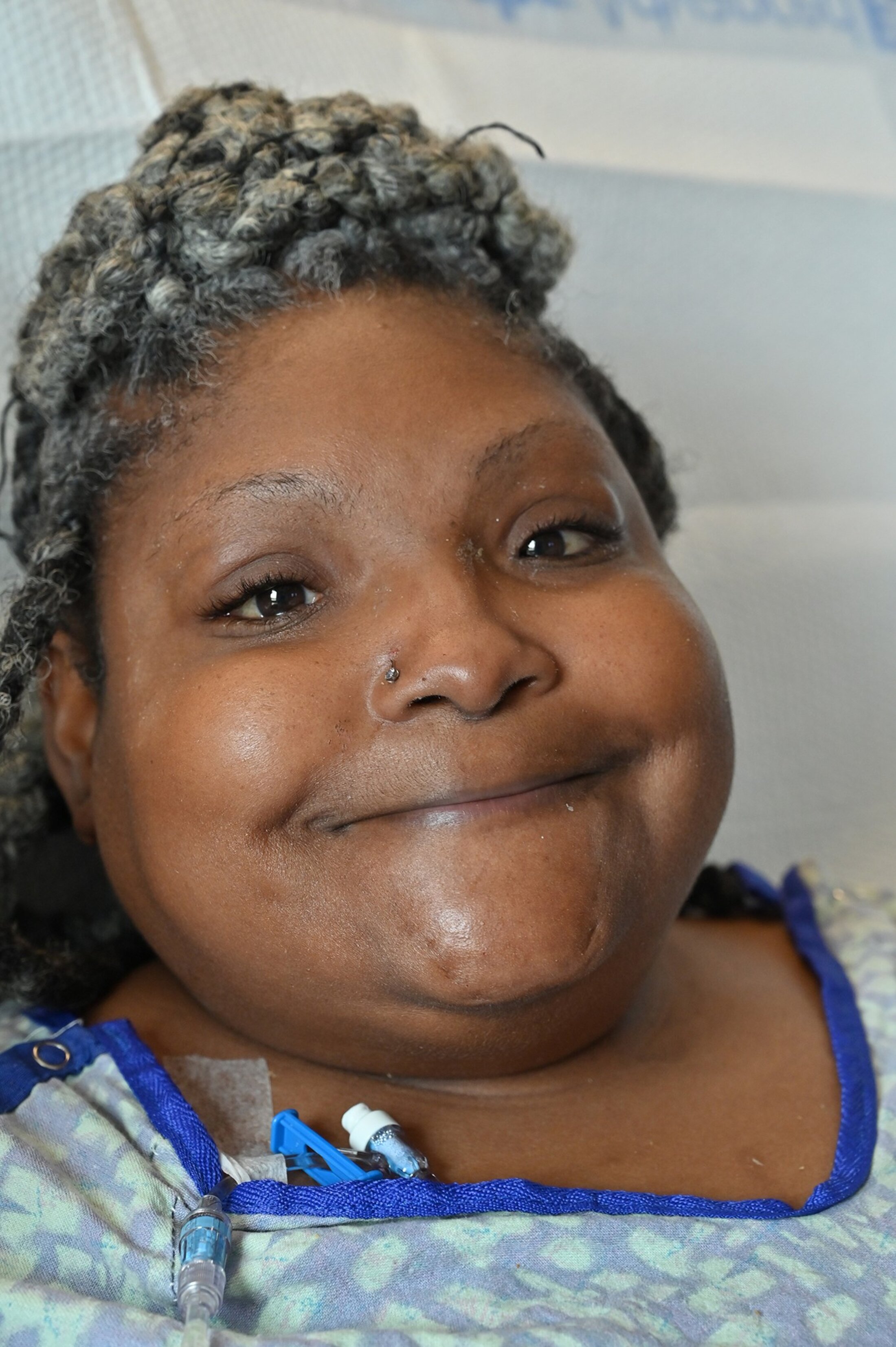 Smiling woman wearing a hospital gown.
