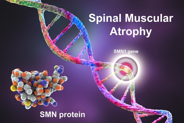 Purple background. On the left is a strand of genetic material. There's also, to the left, a group of green, gray, orange and yellow dots stuck together with the words 