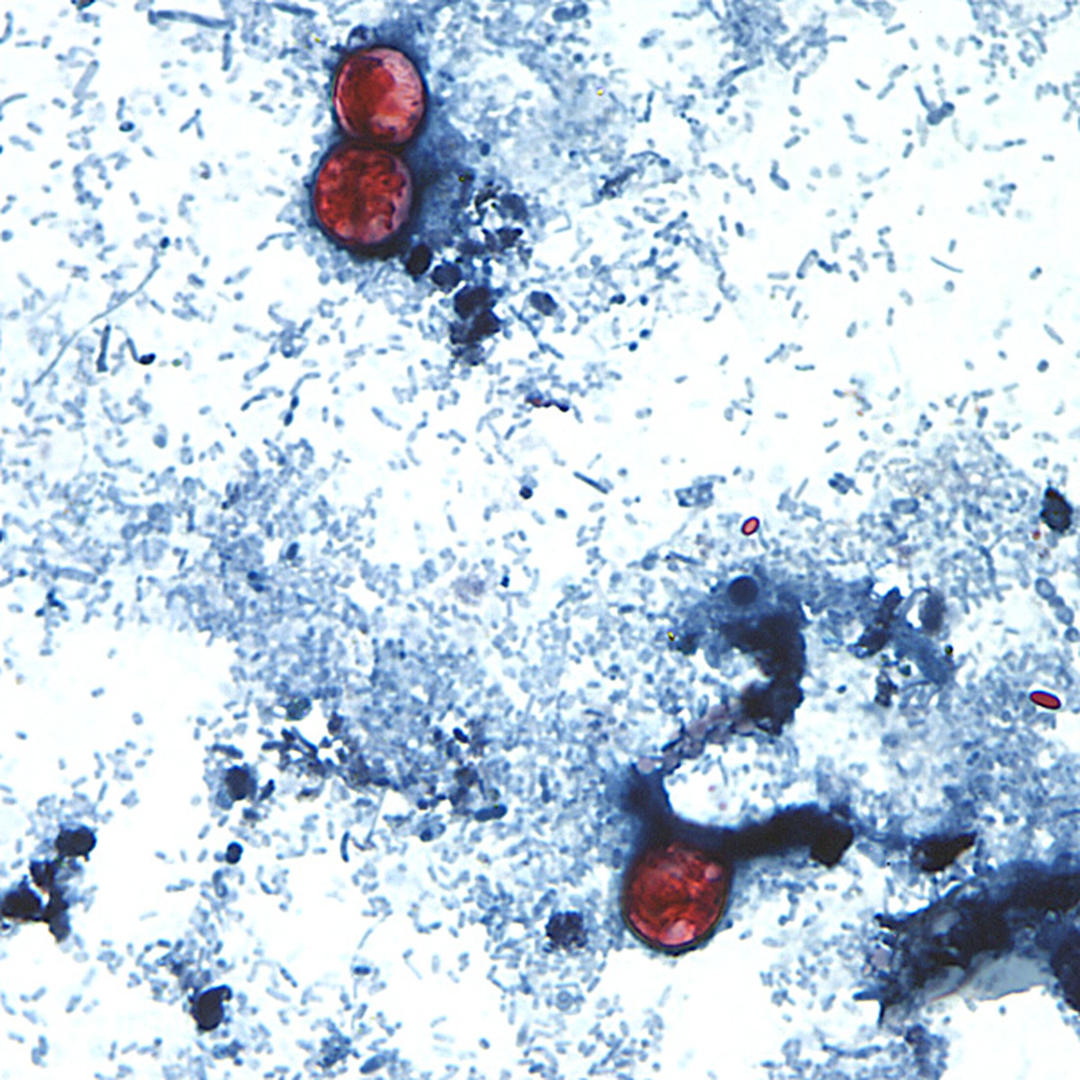 Light blue small sticks on a white background. There are three red blobs - two near the top, the third near the bottom.