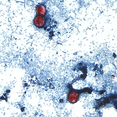 Light blue small sticks on a white background. There are three red blobs - two near the top, the third near the bottom.