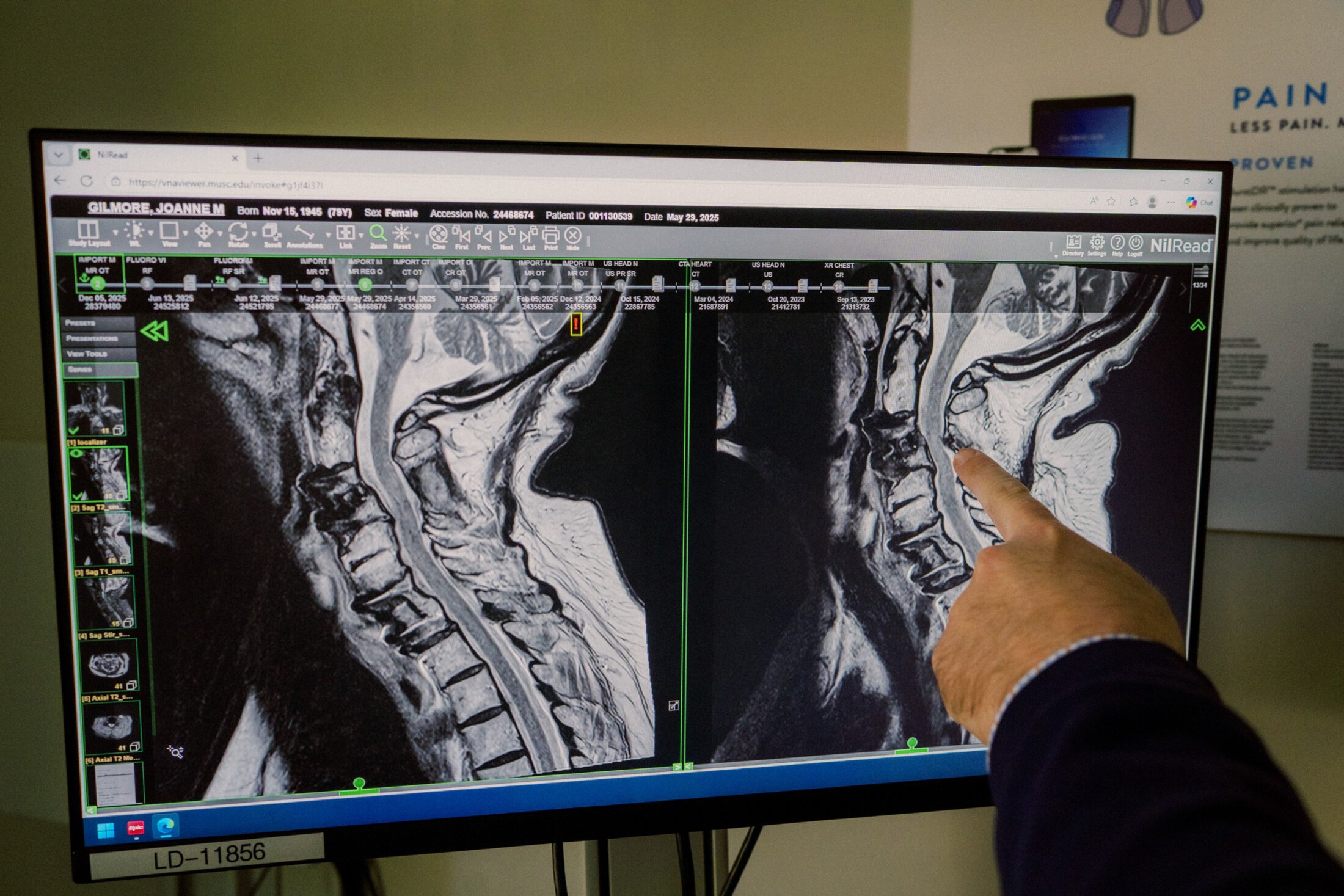 Dr. Jamie Wilson points at an x-ray pulled up on a computer monitor.
