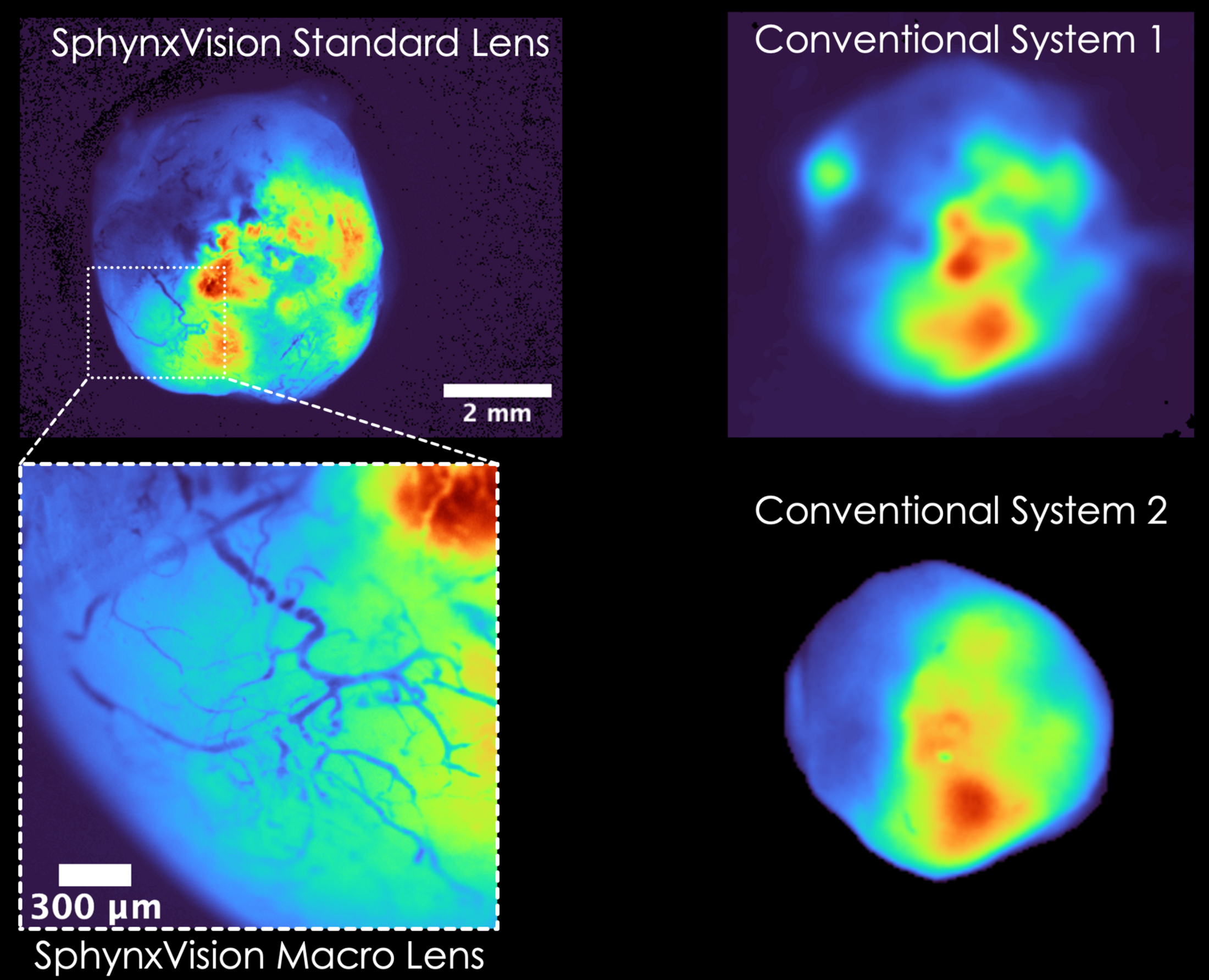 Comparisons of imaging taken from conventional systems and SphynxVision, demonstrating that SphnxVision offers crisp views of blood vessels.