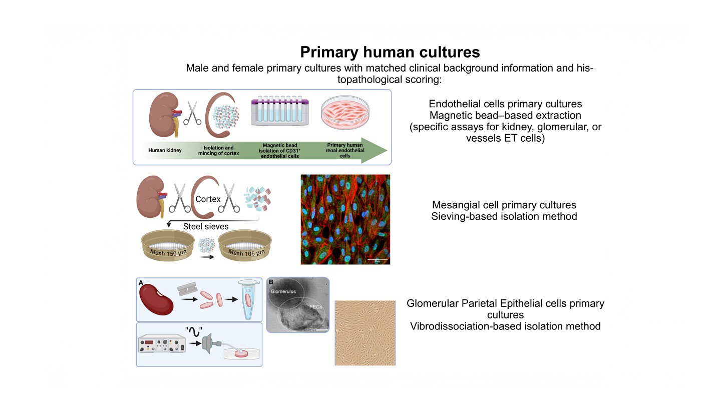 Illustration of Kidney Translational Research Center primary human kidney cell culture workflows using male and female samples with matched clinical background and histopathological scoring. The image shows processes for endothelial cell cultures using magnetic bead-based extraction, mesangial cell cultures using sieving-based isolation, and glomerular parietal epithelial cell cultures using vibrodissociation-based isolation.